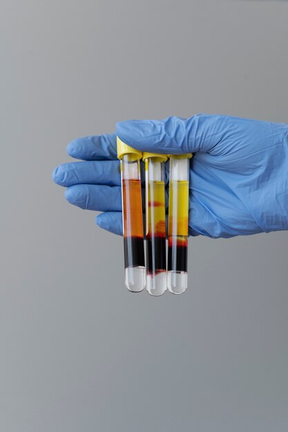 Методы диагностики бактериурии у беременных на поздних сроках