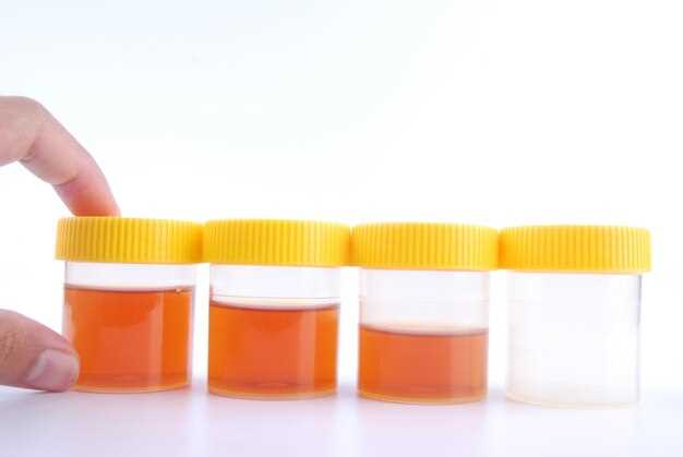 Обострение хронических заболеваний почек