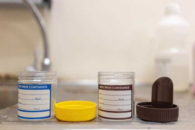 Причины плохих анализов мочи у беременных: диагностические моменты и возможные причины