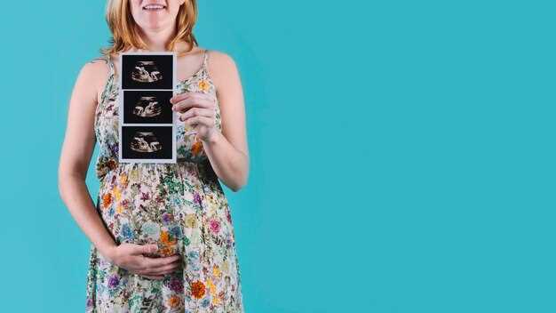 Определение предполагаемой даты родов по акушерским неделям