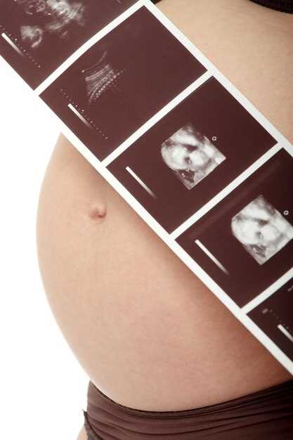 Как оценить состояние плаценты и амниотической жидкости