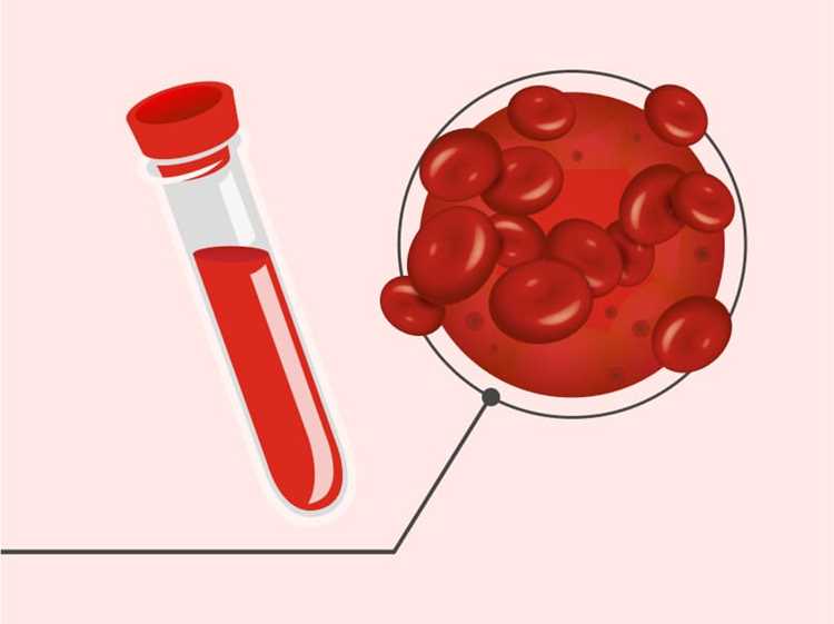Коррекция уровня гематокрита: рекомендации для родителей