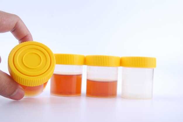 Что означает наличие клеточных элементов кроме лейкоцитов и как их интерпретировать