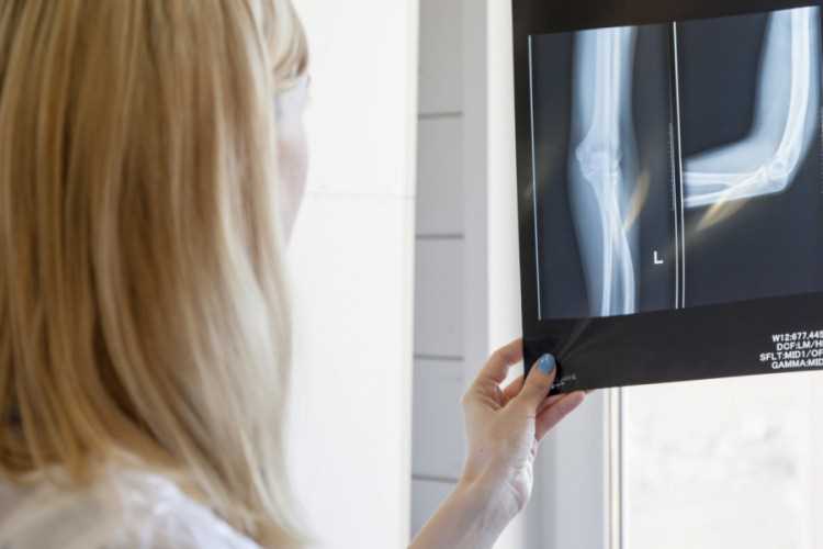 Рекомендации врачей по обследованию с использованием ионизирующего излучения у женщин в ожидании ребенка