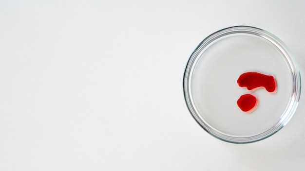 Интерпретация пониженных лейкоцитов у новорожденных