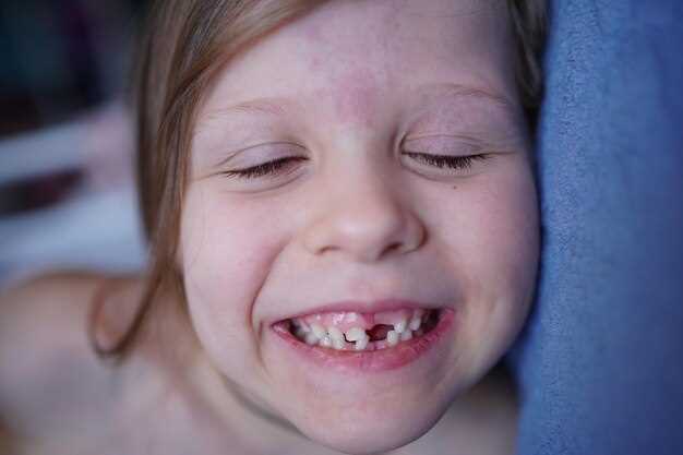 Причины скрежета зубами у 4-летних детей и их особенности