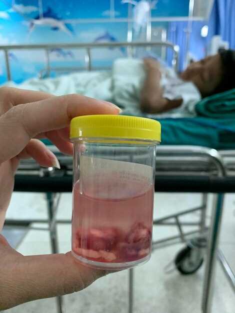 Строение мочевой системы и повышенный риск воспалительных процессов