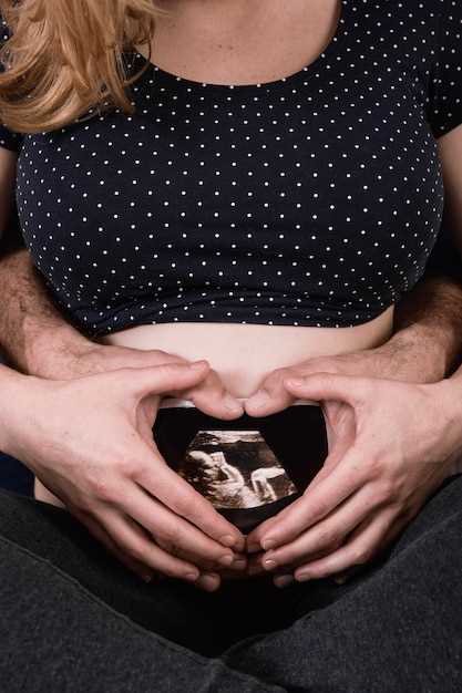 Какие виды положения ребенка бывают в этом сроке