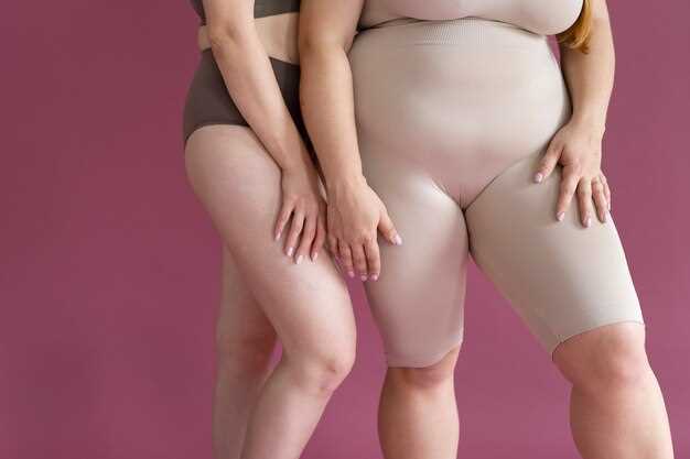 Последствия целлюлита для здоровья и внешности беременной женщины