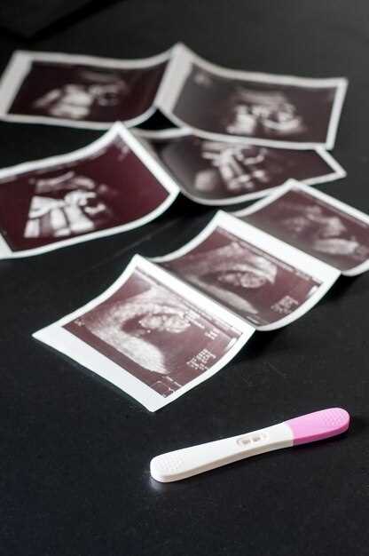 Время проведения УЗИ: оптимальные сроки и возможность повторных осмотров