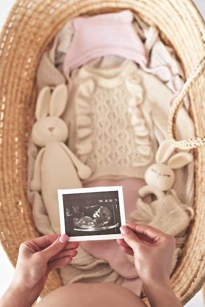 Подготовка к ультразвуковому исследованию перед родами: что важно учесть